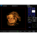 Ecocardiógrafo Doppler color portátil portátil Precio ultrasonido Sonar 2D 3D 4D Ecocardiografía Ecografo USD Echo Machine